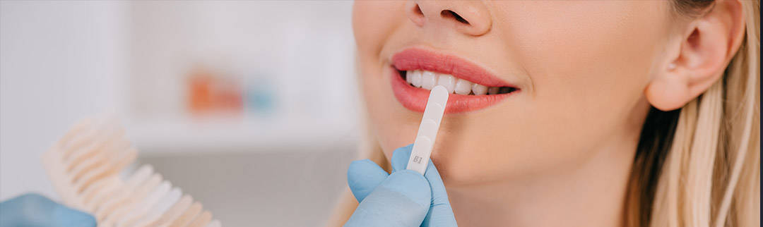 teeth-whitening teeth whitening treatment