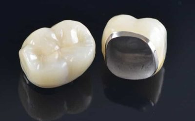 2 Methods to Prolong the Life of your New Dental Crown