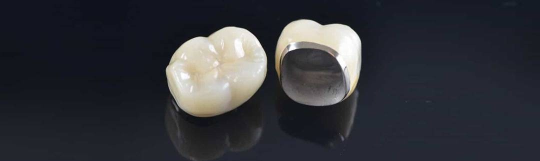 2-methods-to-prolong-Dental-Crown dental crown care