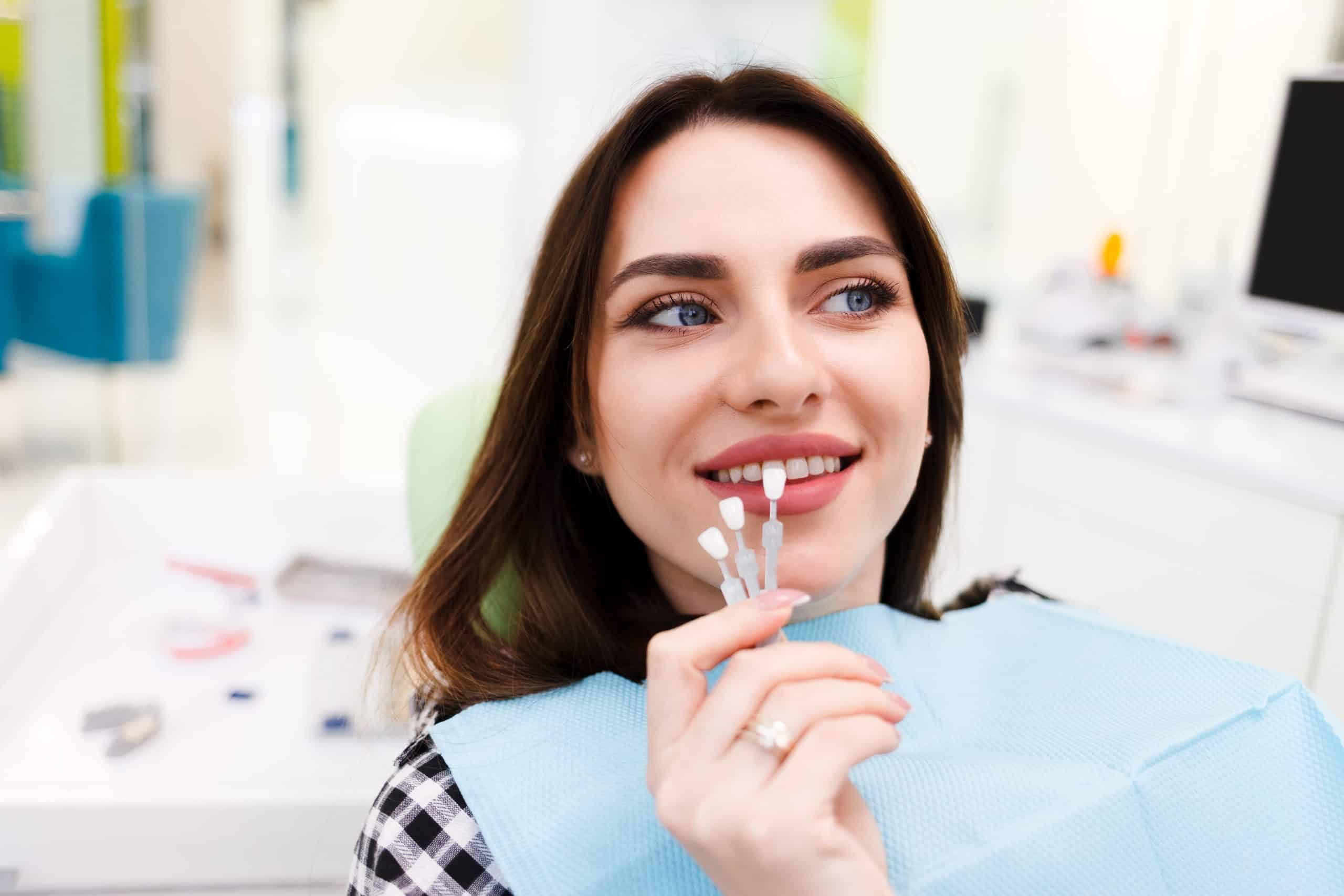 dental veneers