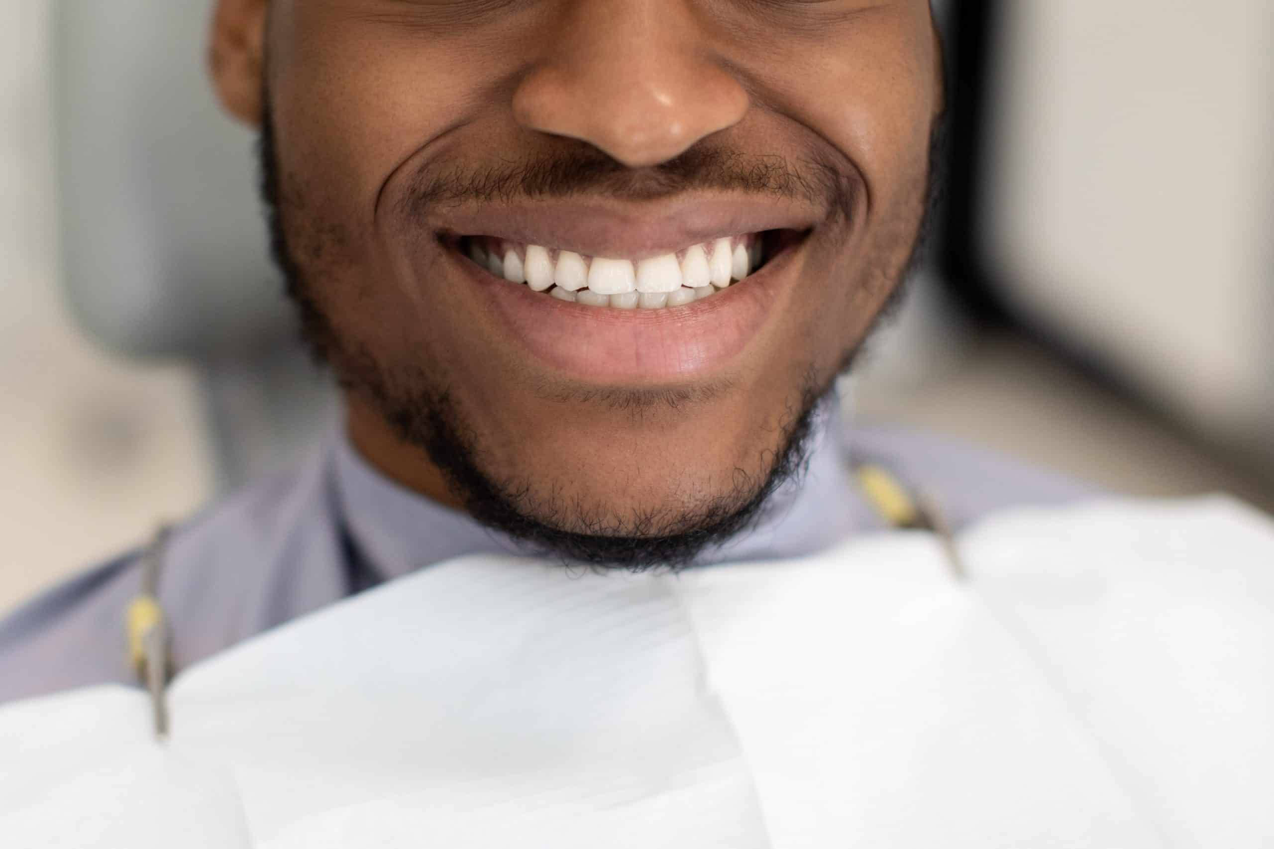 Perfect Teeth Bite Perfect Teeth Bite