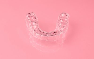 The Importance of Replacing Retainers – Expert Advice for a Lifetime of Straight Teeth