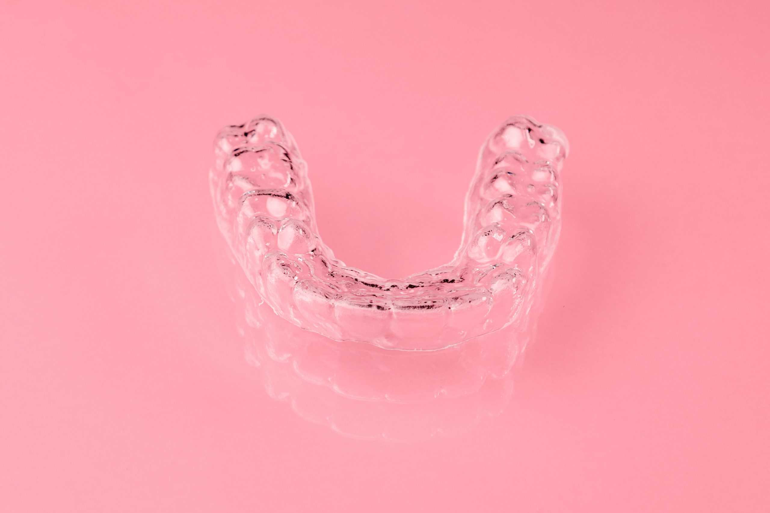 invisible Retainers replacing retainers
