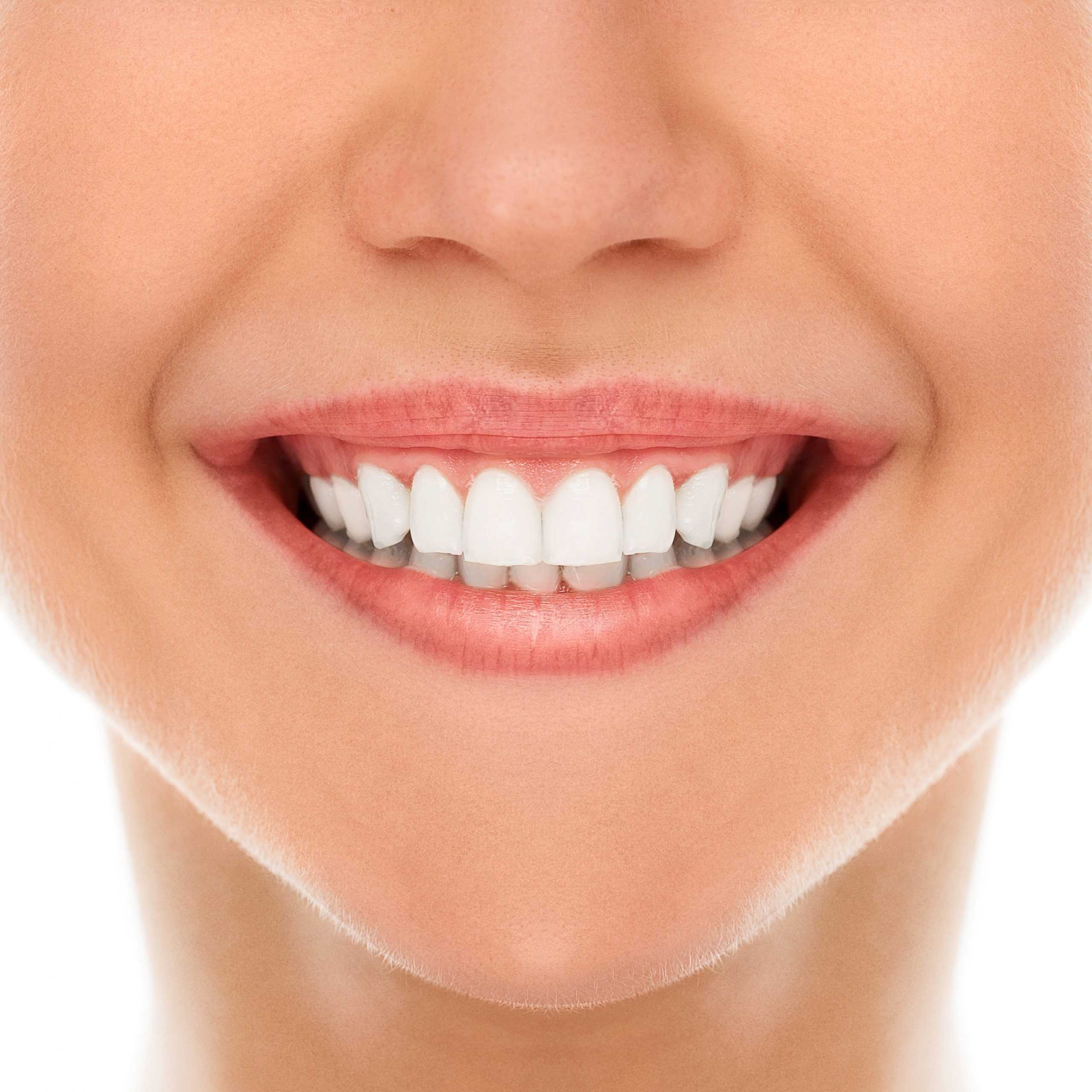 Smile Makeover