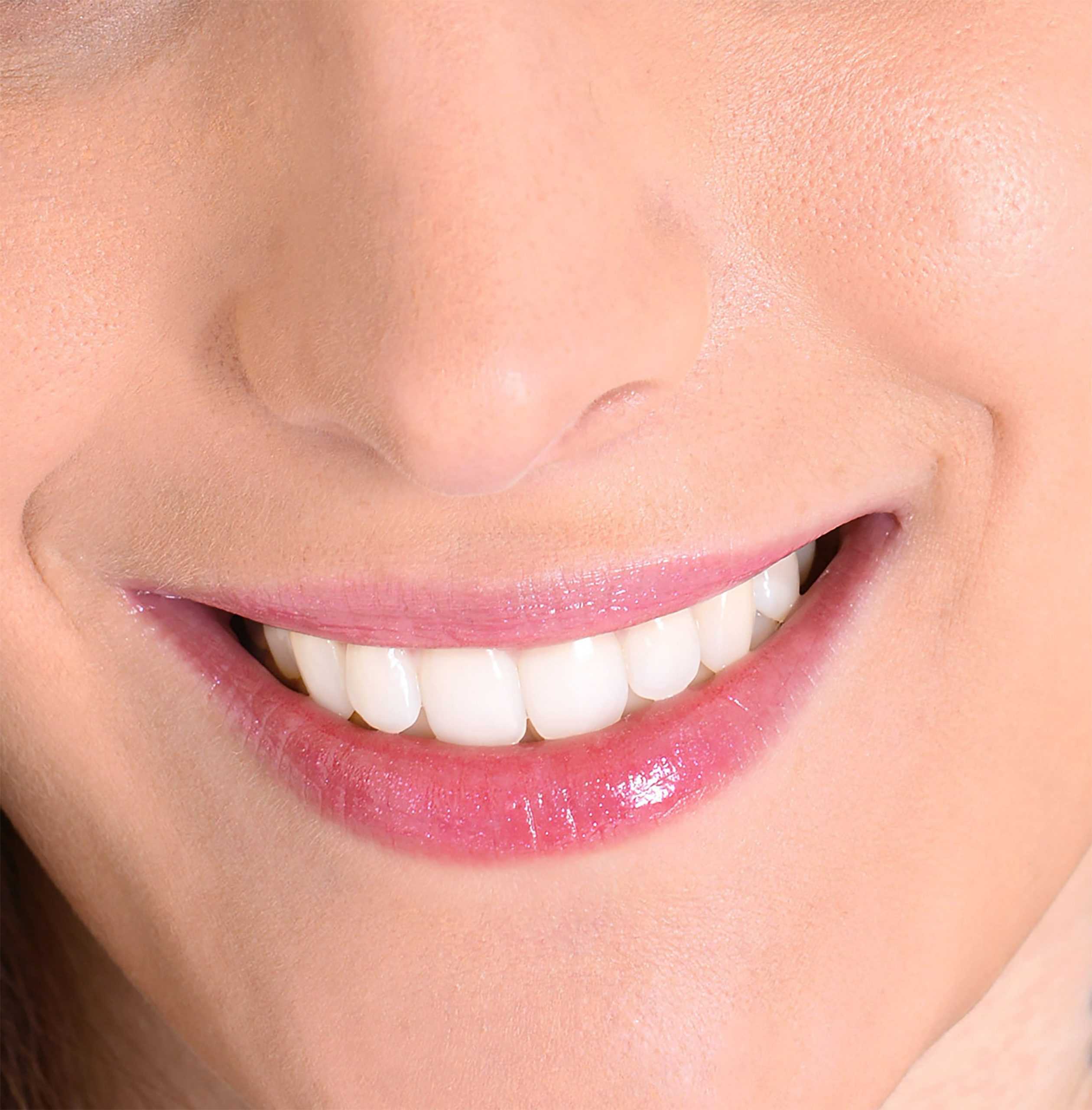 Tooth reshaping