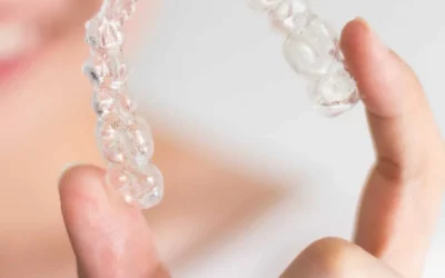 #1 Simple Invisalign Results Timeline: How Long Does Invisalign Take To Straight Teeth?