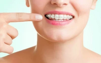 Clear Braces vs Metal Braces: Best Way To Weigh the Pros and Cons