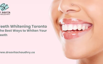 Teeth Whitening Toronto – The Best Ways to Whiten Your Teeth