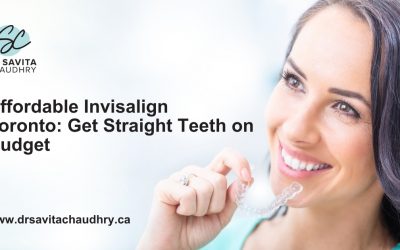 Affordable Invisalign Toronto: Get Straight Teeth on Budget