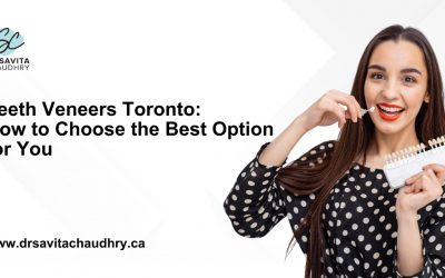 Teeth Veneers Toronto – How to Choose the Best Option for You