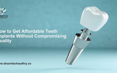 Blog 10 How to Get Affordable Teeth Implants Without Compromising Quality