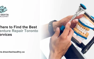 Blog 8 Where to Find the Best Denture Repair Toronto Services