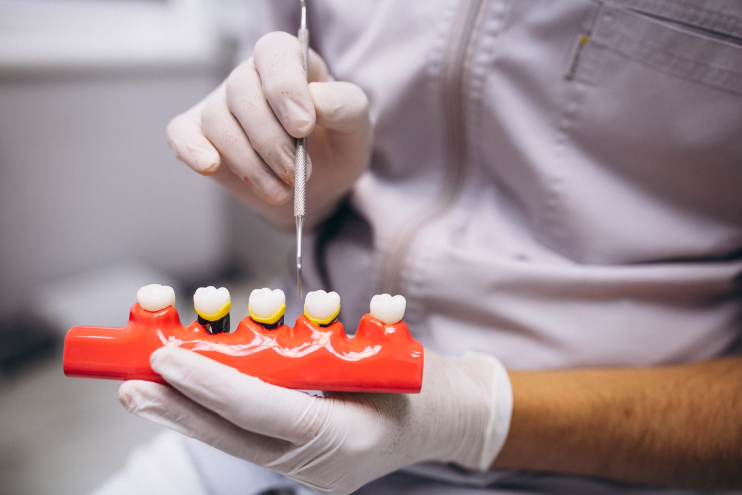 Bone Grafting for Dental Implants