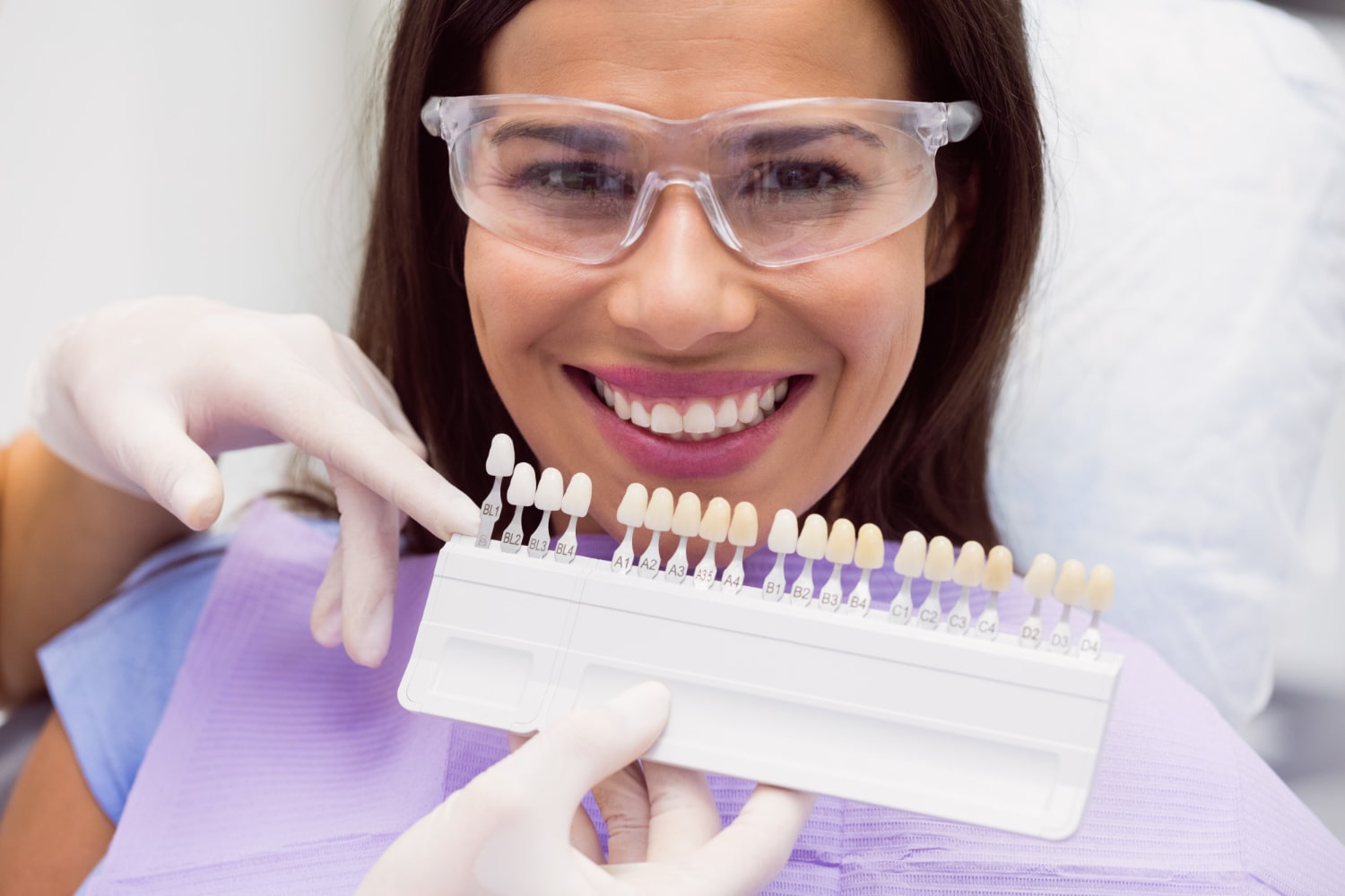 dental bonding vs veeners dental bonding vs veeners