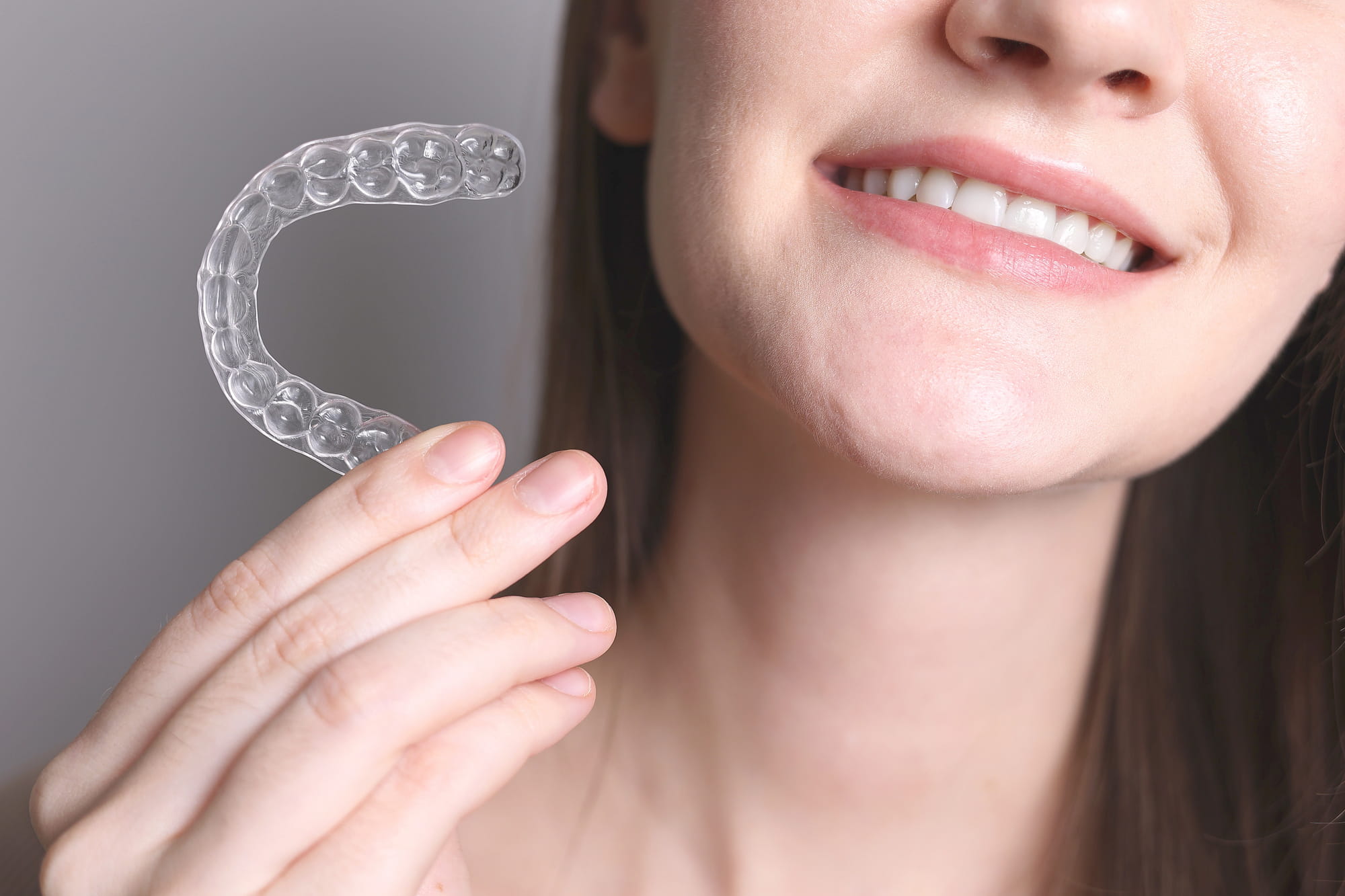 Invisalign Attachments How They Speed Up Teeth Straightening Invisalign Attachments How They Speed Up Teeth Straightening